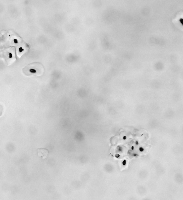Identification and Analysis of Pregelatinized Starch Granules using ImageProVision’s ipvPClass Software.