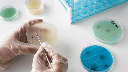 Difficulty Differentiating Overlapping or Faint Colonies