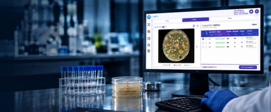 CLAIRITY™ MICROBE – Automated Colony Counting and Microbial Analysis