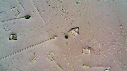 Contaminant Differentiation in Complex Samples
