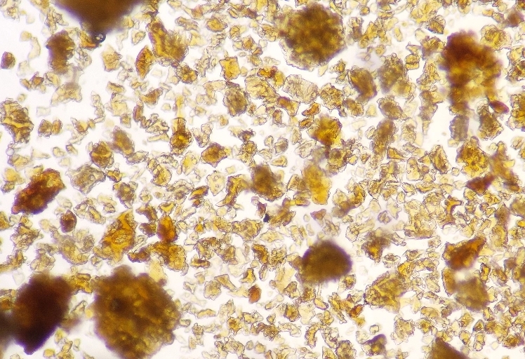 Why particle size matters