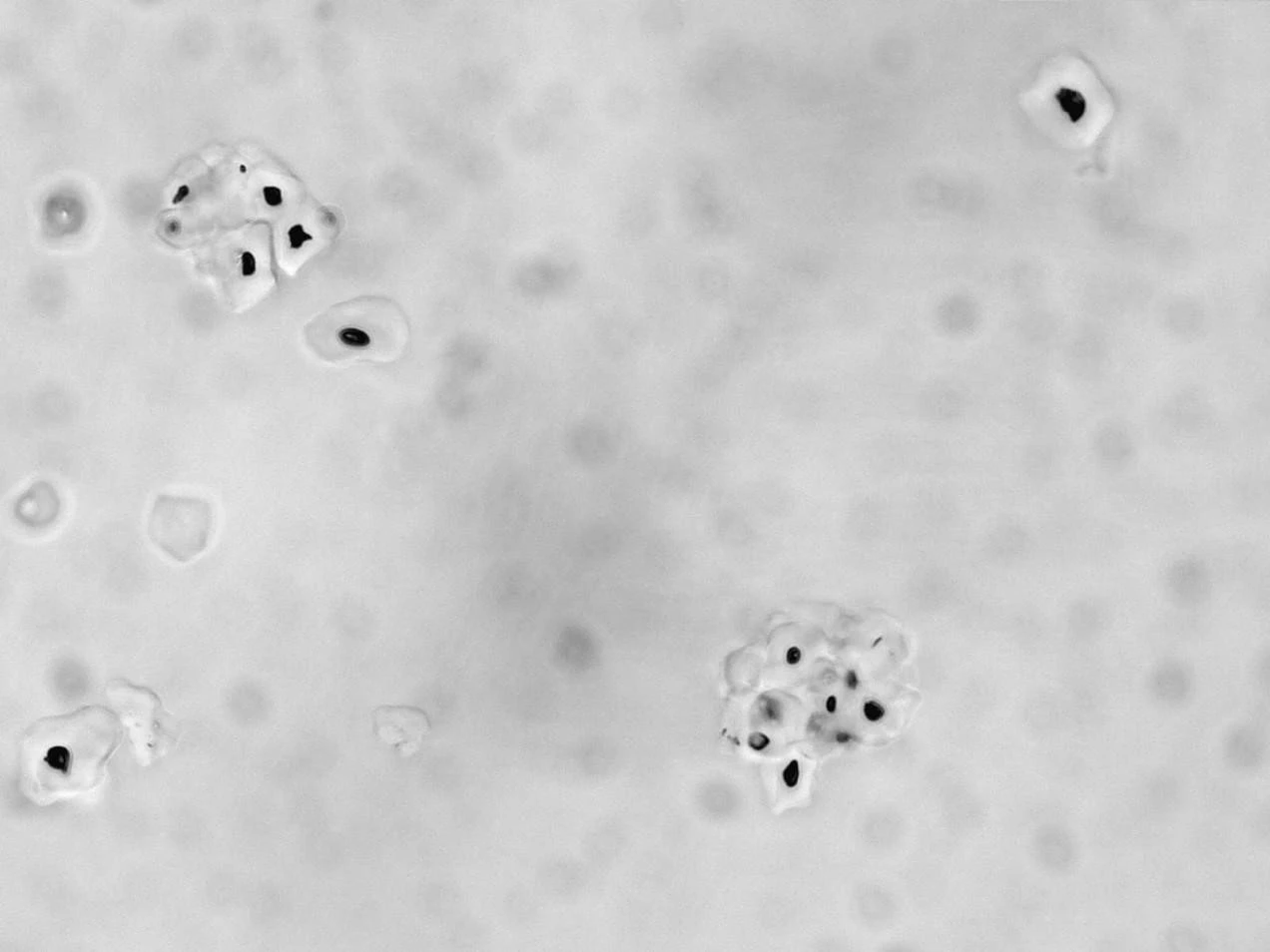 Identification and Analysis of Pregelatinized Starch Granules using ImageProVision’s ipvPClass Software.