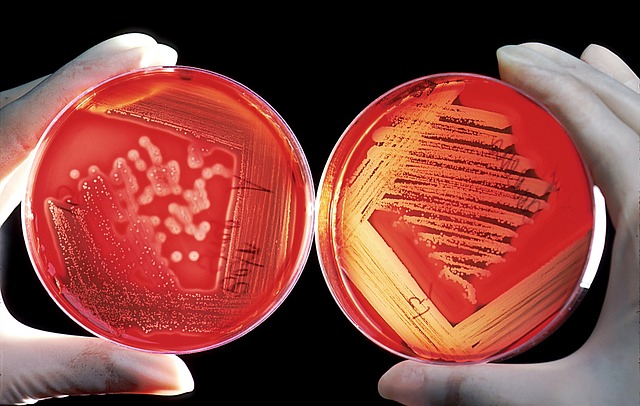 Beyond Enumeration: ipvMicrobe Colony Counters