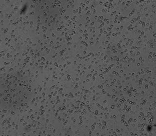 Globule Size Determination in semi-solid dosage forms