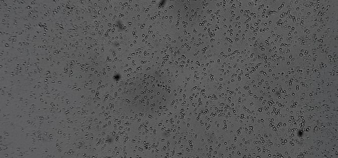 Globule Size Determination in semi-solid dosage forms