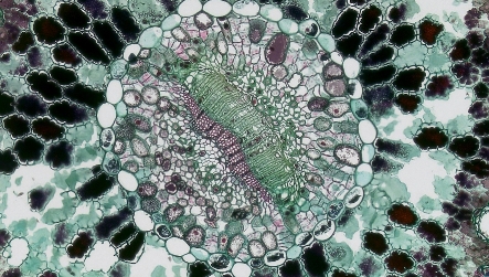 Overlapping or Clumped Cells